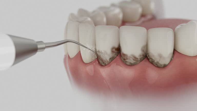 Trusted Tooth Extraction service in Bowie, TX - Dentist Open Now